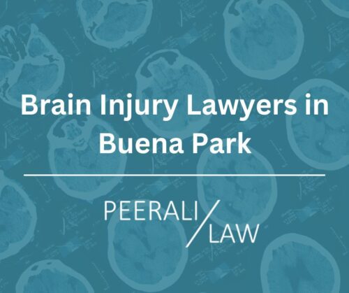 Abogados De Lesiones Cerebrales En Buena Park - Peerali Law