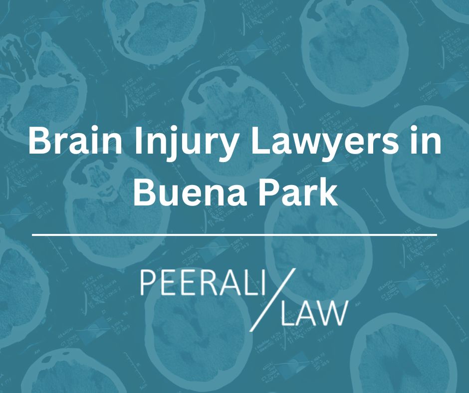 Brain Injury Lawyers in Buena Park